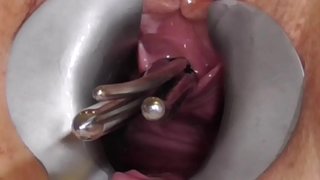 ���ოყვარული FreyjaAnalslut: ღეროები Freyja ის pisshole